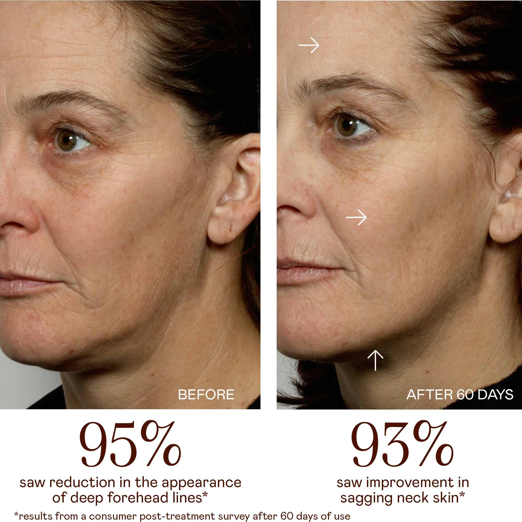 MINI+ Starter Kit - Petite Pro-Longevity Microcurrent Facial Sculpting Device - Image 5