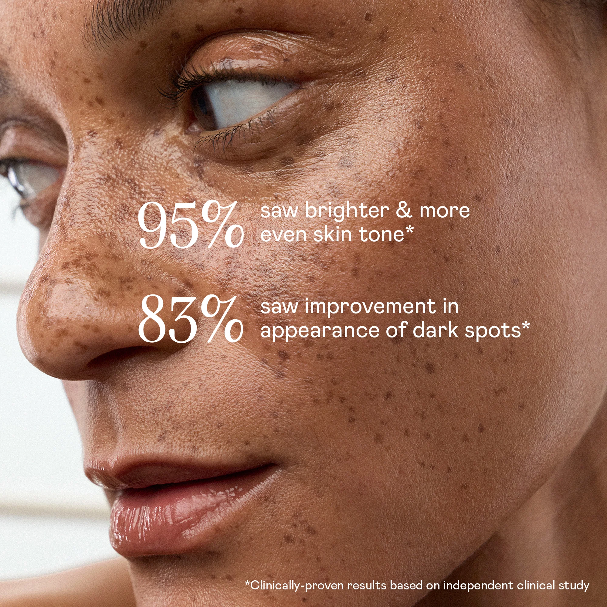 Super Vita-C Booster Serum - Brightening Vitamin C Serum - Image 4