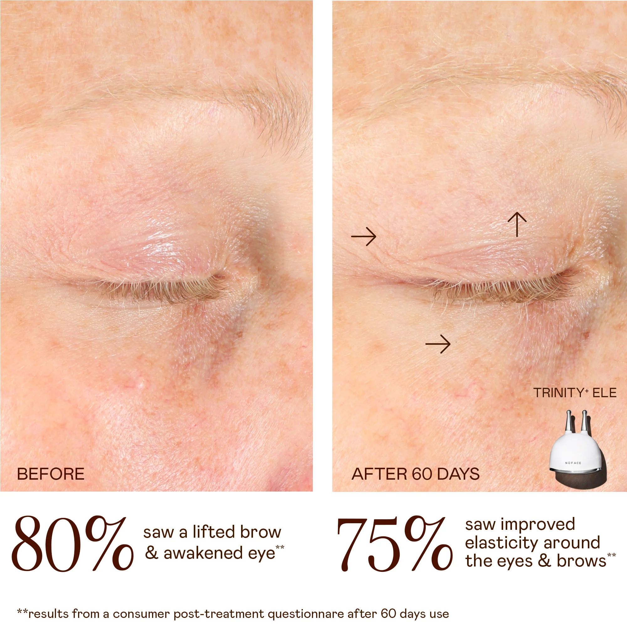 TRINITY+ Lifting & Smoothing Lip & Eye Microcurrent Attachment - Image 4