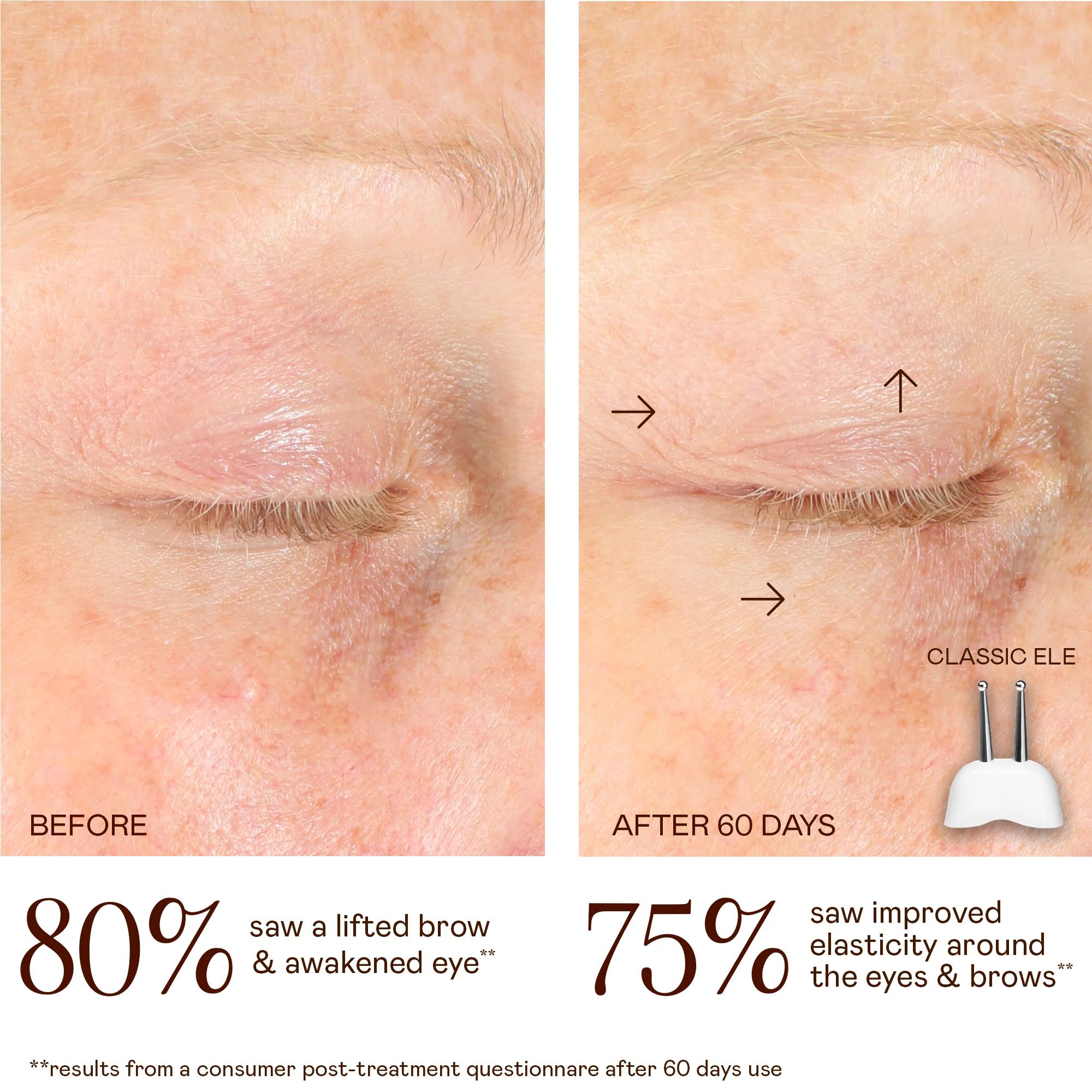 TRINITY CLassic Lifting & Smoothing Lip & Eye Microcurrent Attachment - Image 3