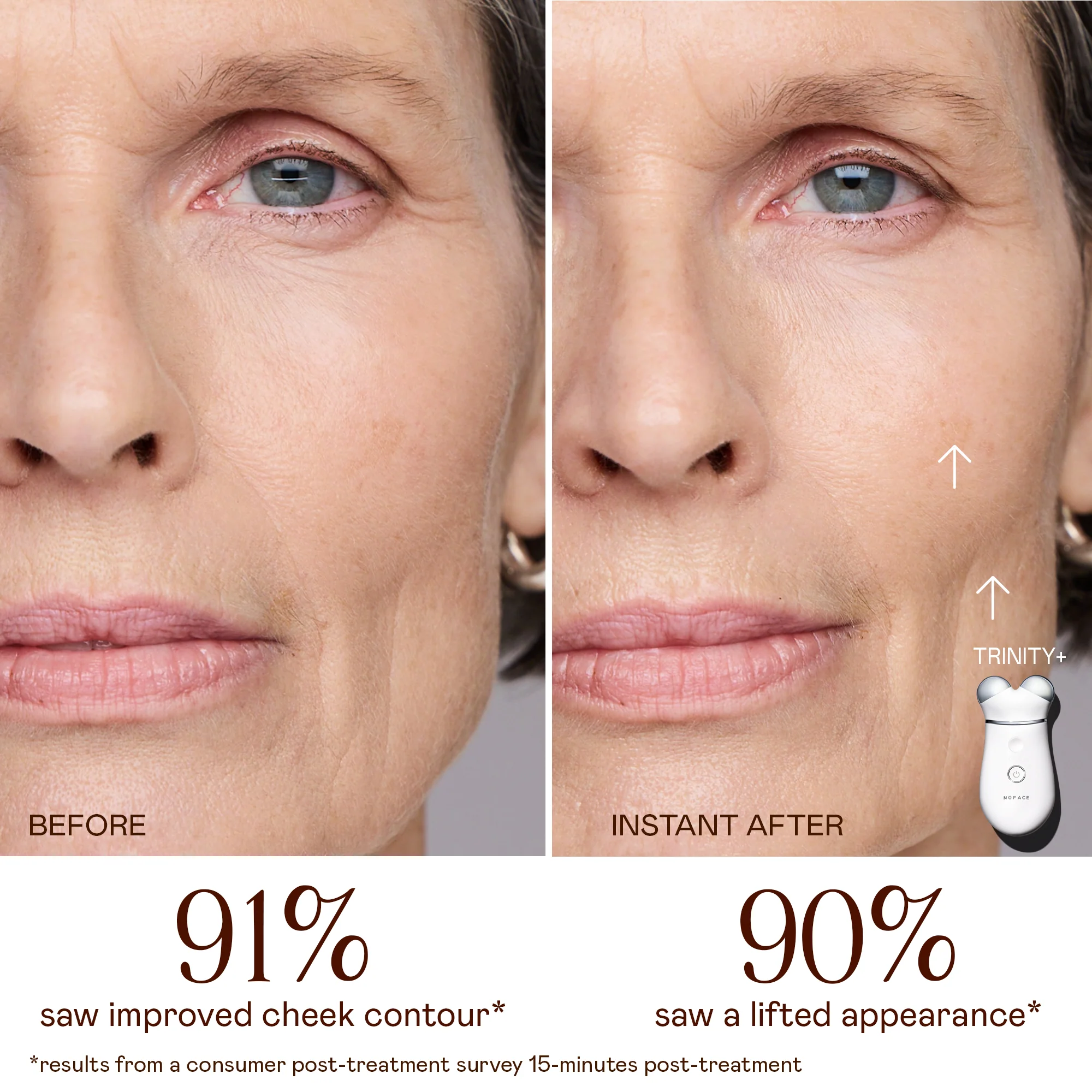 TRINITY+ Starter Kit - Pro-Longevity Microcurrent Facial Lifting Device - Image 3